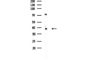 Western blot analysis of lysates from MCF7 cells(heat-shock,45 min treatment), using GAL Antibody at 1/1000 dilution.