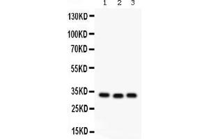 Western blot analysis of GC1q R expression in rat liver extract ( Lane 1), mouse spleen extract ( Lane 2) and MCF-7 whole cell lysates ( Lane 3).