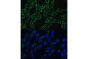 Immunofluorescence analysis of C6 cells using  Polyclonal Antibody (ABIN7265509) at dilution of 1:100 (40x lens). (AEBP1 抗体  (AA 999-1158))