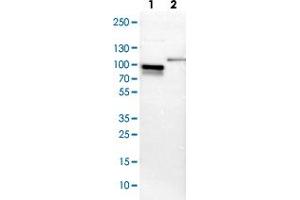 Western blot analysis of Lane 1: NIH-3T3 cell lysate (Mouse embryonic fibroblast cells), Lane 2: NBT-II cell lysate (Rat Wistar bladder tumour cells) with SH3KBP1 polyclonal antibody . (SH3KBP1 抗体)