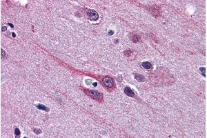 ABIN334408 (3. (GBX2 抗体  (Internal Region))