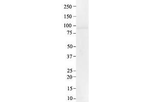 Western Blotting (WB) image for anti-Protein Tyrosine Phosphatase, Receptor Type, N (PTPRN) (Middle Region) antibody (ABIN2782197)