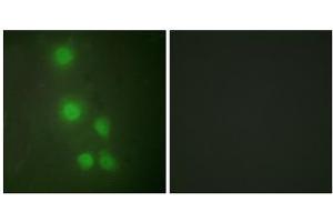 Immunofluorescence analysis of HUVEC cells, using ACL6A antibody. (BAF53A 抗体  (Internal Region))