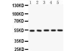 Anti-ARSA Picoband antibody, Western blotting All lanes: Anti ARSA  at 0. (Arylsulfatase A 抗体  (C-Term))