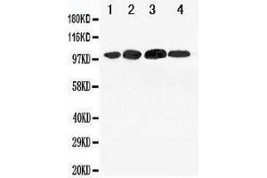 Anti-Mineralocorticoid Receptor antibody, Western blotting Lane 1: 293T Cell Lysate Lane 2: SMMC Cell Lysate Lane 3: SW620 Cell Lysate Lane 4: HELA Cell Lysate (NR3C2 抗体  (C-Term))