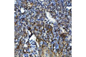 IHC analysis of GPCR RDC1/CXCR-7/ACKR3 using anti-GPCR RDC1/CXCR-7/ACKR3 antibody (ABIN7602889). (CXCR7 抗体  (C-Term))