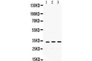 Western Blotting (WB) image for anti-Superoxide Dismutase 3, Extracellular (SOD3) (AA 37-75), (N-Term) antibody (ABIN3043936) (SOD3 抗体  (N-Term))