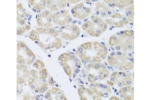 Immunohistochemistry of paraffin-embedded Human stomach using DISC1 Polyclonal Antibody at dilution of 1:100 (40x lens). (DISC1 抗体)