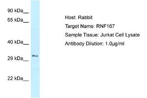 Host: Rabbit Target Name: RNF167 Sample Type: Jurkat Whole Cell lysates Antibody Dilution: 1. (RNF167 抗体  (C-Term))