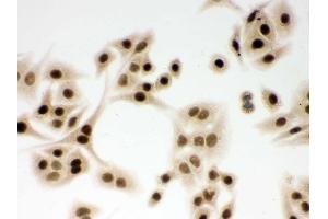 IHC analysis of DDB1 using anti-DDB1 antibody .