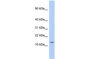 SNRPD2 antibody used at 1 ug/ml to detect target protein. (SNRPD2 抗体  (N-Term))