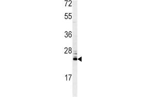 Western Blotting (WB) image for anti-Methionine Sulfoxide Reductase A (MSRA) antibody (ABIN3003138) (MSRA 抗体)