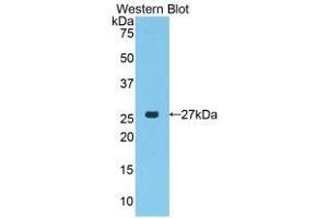 Western blot analysis of the recombinant protein. (PRTN3 抗体  (AA 24-249))