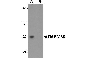 Western Blotting (WB) image for anti-Transmembrane Protein 59 (TMEM59) (N-Term) antibody (ABIN1031631) (TMEM59 抗体  (N-Term))