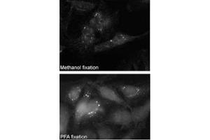 Immunofluorescence (IF) image for anti-Sequestosome 1 (SQSTM1) (AA 317-346) antibody (ABIN3031543)