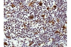 IHC-P Image Immunohistochemical analysis of paraffin-embedded Human lymph tissue, using HICE1 , antibody at 1:50 dilution. (NYS48/HAUS8 抗体)