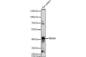 Western blot analysis of extracts of Rat spleen, using TIMD4 antibody (ABIN7270705) at 1:1000 dilution. (TIMD4 抗体  (AA 25-130))