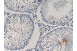 DAB staining on IHC-P; Samples: Rat Testis Tissue (POMC 抗体  (AA 27-235))