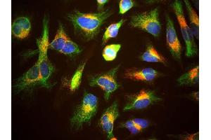 HeLa cells staining with ABIN1580431 (red), and counterstained with chicken polyclonal antibody to Vimentin CPCA-Vim (green) and DNA (blue). (LAMP1 抗体)