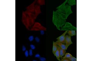 ABIN6257953 and ABIN6274909 staining Hela cells(30 min of UV treatment) by IF/ICC. (B4GALNT1 抗体  (Internal Region))