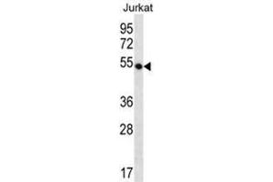 WDR40A Antibody (Center) western blot analysis in Jurkat cell line lysates (35 µg/lane). (DCAF12 抗体  (Middle Region))
