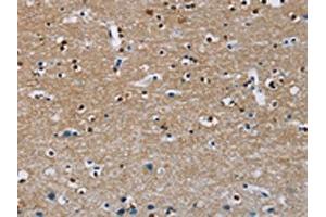 The image on the left is immunohistochemistry of paraffin-embedded Human brain tissue using ABIN7130272(MSH5 Antibody) at dilution 1/30, on the right is treated with fusion protein. (MSH5 抗体)