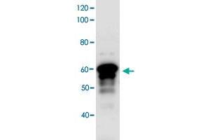 Western blot analysis bacterial lysate of MBP-fused antigen protein by using Myt1l polyclonal antibody (Cat.