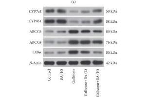 Western Blotting (WB) image for anti-ATP-Binding Cassette, Sub-Family G (WHITE), Member 5 (ABCG5) (AA 350-450) antibody (ABIN6136382)