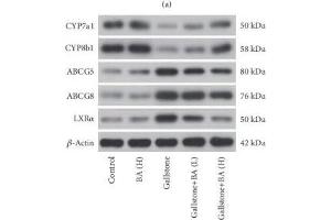 Lithogenic diet induced disorders of cholesterol synthesis and transport in liver. (ABCG5 抗体  (AA 350-450))