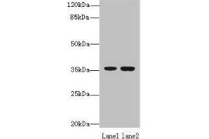 Western blot All lanes: EEF2KMT antibody at 6 μg/mL Lane 1: Hela whole cell lysate Lane 2: 293T whole cell lysate Secondary Goat polyclonal to rabbit IgG at 1/10000 dilution Predicted band size: 37, 34 kDa Observed band size: 37 kDa (EEF2KMT (AA 1-330) 抗体)