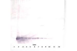 Image no. 2 for anti-gamma-Interferon-Induced Monokine (CXCL9) antibody (ABIN465878) (CXCL9 抗体)