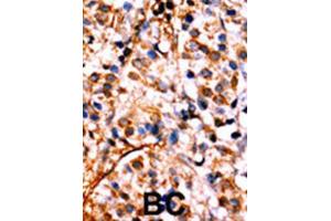 Immunohistochemistry (IHC) image for anti-Nuclear Factor kappa B (NFkB) (pSer536) antibody (ABIN3001768) (NFkB 抗体  (pSer536))