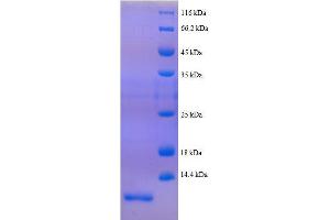 SDS-PAGE (SDS) image for Peptide YY (PYY) (AA 31-64), (full length) protein (His tag) (ABIN1047501)