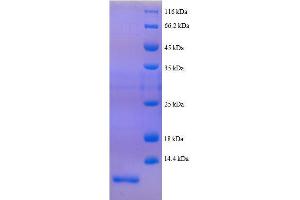 Peptide YY (AA 31-64), (full length) protein (His tag) (Peptide YY Protein (PYY) (AA 31-64, full length) (His tag))