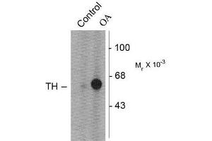 Image no. 1 for anti-Tyrosine Hydroxylase (TH) (pSer31) antibody (ABIN372737)