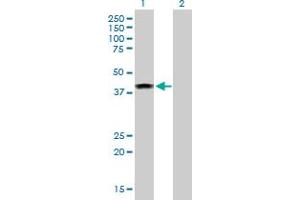 Western Blot analysis of ELAC1 expression in transfected 293T cell line by ELAC1 MaxPab polyclonal antibody. (ELAC1 抗体  (AA 1-363))