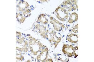 Immunohistochemistry of paraffin-embedded human stomach using MGAT1 antibody. (MGAT1 抗体)