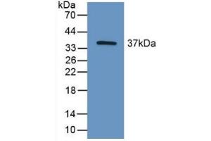 Detection of Recombinant HIF2a, Mouse using Polyclonal Antibody to Hypoxia Inducible Factor 2 Alpha (HIF2a) (EPAS1 抗体  (AA 21-336))