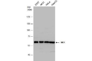 WB Image ME1 antibody detects ME1 protein by western blot analysis. (ME1 抗体)