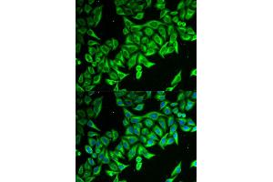 Immunofluorescence (IF) image for anti-Death-Associated Protein (DAP) antibody (ABIN1877136) (DAP 抗体)