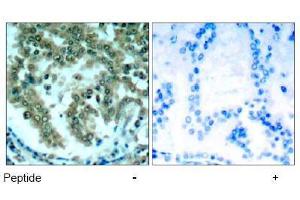Image no. 1 for anti-Protein Kinase C, theta (PRKCQ) (AA 674-678) antibody (ABIN197567) (PKC theta 抗体  (AA 674-678))