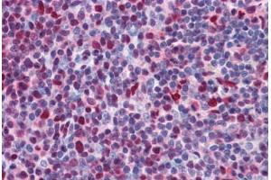 Human Tonsil: Formalin-Fixed, Paraffin-Embedded (FFPE) (CHD4 抗体  (AA 71-120))