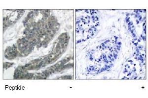 Image no. 1 for anti-Docking Protein 1, 62kDa (Downstream of tyrosine Kinase 1) (DOK1) (Tyr398) antibody (ABIN197538)