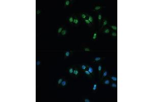 Immunofluorescence analysis of U-2 OS cells using TDP-43/TARDB Polyclonal Antibody (ABIN7270731) at dilution of 1:100 (40x lens).