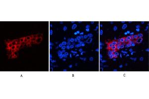 Immunofluorescence analysis of human liver tissue. (Cytokeratin 7 抗体)
