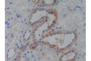 DAB staining on IHC-P;;Samples: Human Kidney Tissue (IGF2BP3 抗体  (AA 2-343))