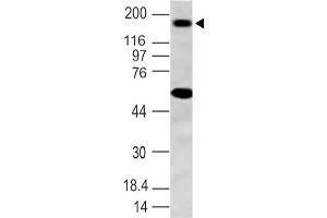 Image no. 1 for anti-NLR Family, Pyrin Domain Containing 3 (NLRP3) (AA 150-385) antibody (ABIN5027384) (NLRP3 抗体  (AA 150-385))