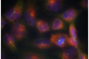 Image no. 1 for anti-Microtubule-Associated Protein tau (MAPT) (Ser356) antibody (ABIN401616) (MAPT 抗体  (Ser356))