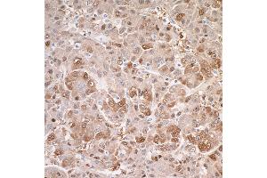 anti-Arginase, Liver (ARG1) (AA 1-322) antibody