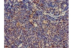 Immunohistochemistry of paraffin-embedded human lymph node tissue using ABIN7171394 at dilution of 1:100 (CD247 抗体  (AA 88-153))